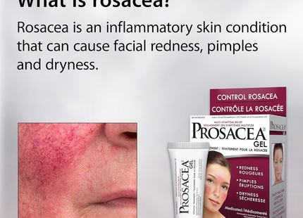 Prosacea - Rosacea Gel Treatment | 21.25 g