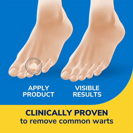Dr. Scholl's - Clear Away Wart Remover Salicylic Acid Treatment for Common Warts |  9 Strips 12 Medicated Discs