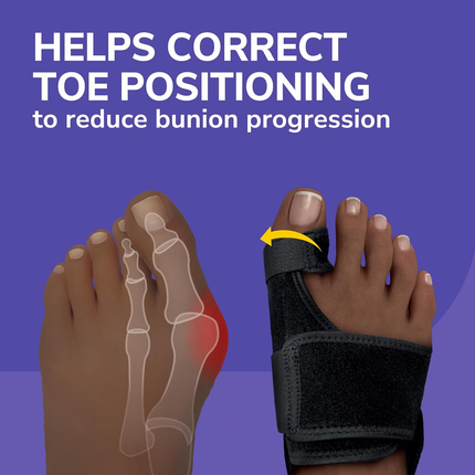 Dr. Scholl's - Bunion Relief & Toe Corrector | 1 Left & 1 Right