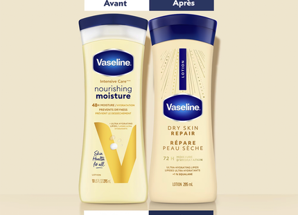 Vaseline - Intensive Care Body Lotion Dry Skin Repair with Squalene 1% | 295 mL