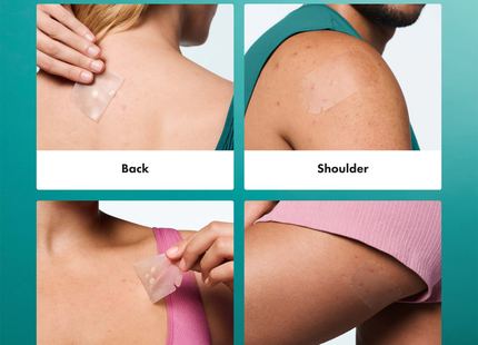 Hero Cosmetics - Mighty Body Patch for Big Breakout Areas | 4 Hydrocolloid Patches
