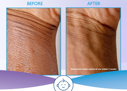 Glaxal Base - Hydrating Lotion with Vitamin E | 227 g