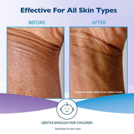 Glaxal Base - Lotion Hydratante à la Vitamine E | 227 g
