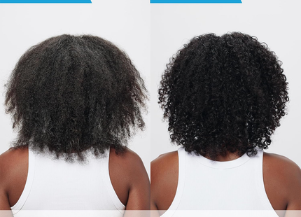 CeraVe - 2IN1 Anti-Dandruff Hydrating Shampoo and Conditioner, For All Hair Types | 355 mL