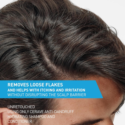 CeraVe - Anti Dandruff Hydrating Conditioner, Removes loose Flakes, Sulfate-Free, For All Hair Types | 266 mL