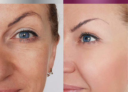 Skincare LdeL Cosmetics - Retinol Eye Gel, Vitamin A + C + E | 15 g