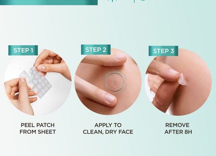 Garnier - Patchs anti-imperfections au charbon SkinActive