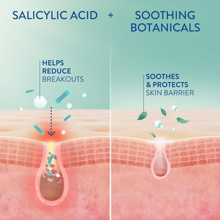 Cetaphil - Gentle Salicylic Acid Moisturizer | 89 mL