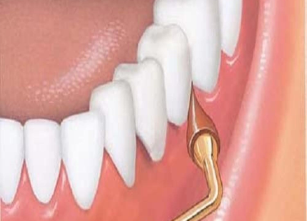 GUM - Stimulator Combo Long Handled Massager Remove Plaque & Promote Health (Handle + 2 Refill Packs)